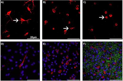 Brivaracetam exhibits mild pro-inflammatory features in an in vitro astrocyte-microglia co-culture model of inflammation